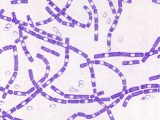 Bacillus anthracis