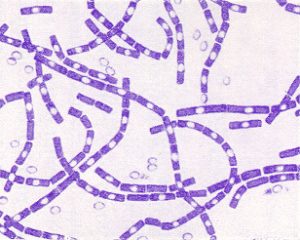 Bacillus anthracis